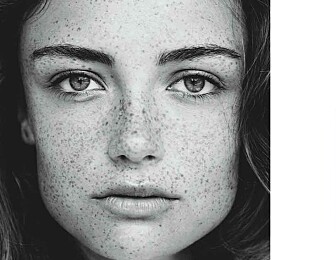 Her er 3 skånsomme alternativer til retinol